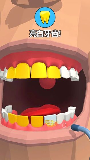 拔牙大师(Dentist Bling)