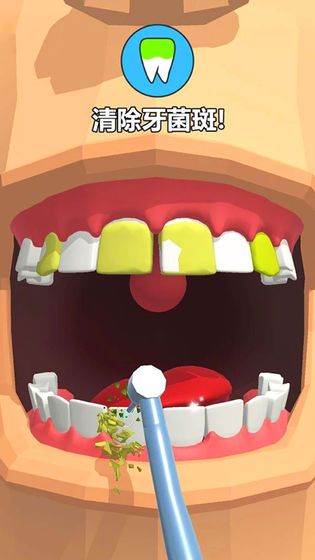 拔牙大师(Dentist Bling)
