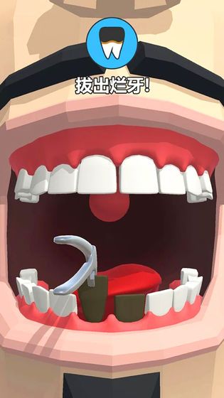 拔牙大师(Dentist Bling)